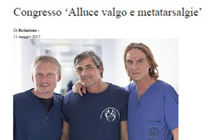 Alluce valgo, la chirurgia è 